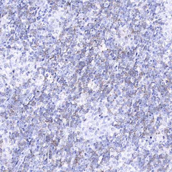 PD-1/CD279 Mouse Monoclonal Antibody