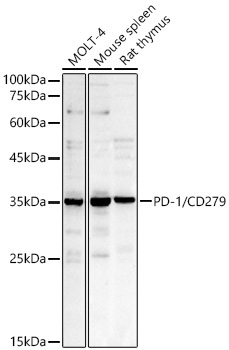 PD-1/CD279 Rabbit Polyclonal Antibody