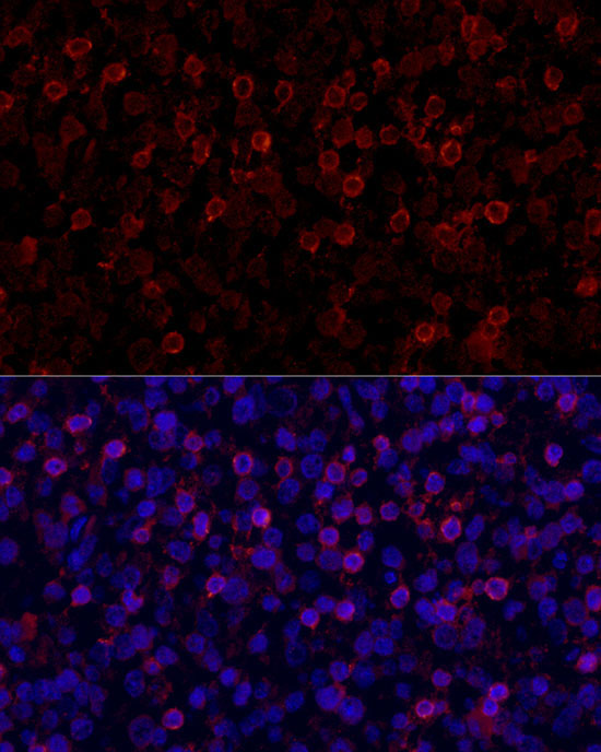 PD-1/CD279 Rabbit Polyclonal Antibody - Image 2