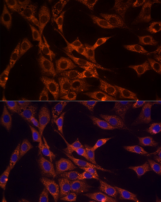 PDCD1LG2 Rabbit Polyclonal Antibody - Image 3