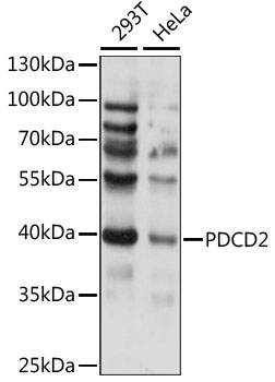 PDCD2 Rabbit Polyclonal Antibody