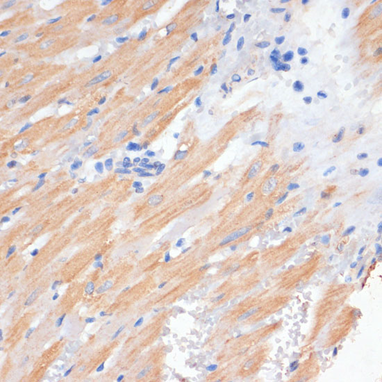 PDCD2L Rabbit Polyclonal Antibody - Image 2