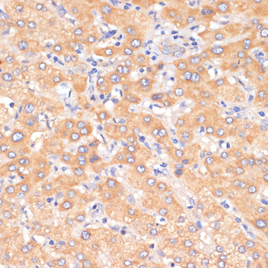 PDCD2L Rabbit Polyclonal Antibody - Image 3