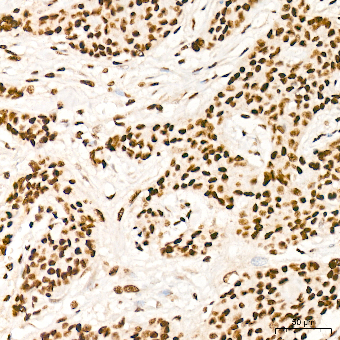 PDCD7 Rabbit Monoclonal Antibody - Image 3