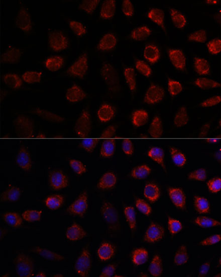 PDE11A Rabbit Polyclonal Antibody - Image 2