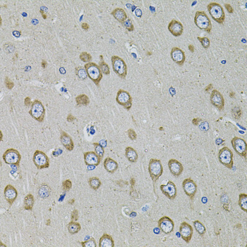 PDE1B Rabbit Polyclonal Antibody - Image 2