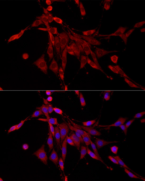 PDE4C Rabbit Polyclonal Antibody