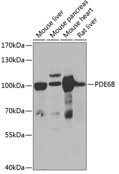 PDE6B Rabbit Polyclonal Antibody