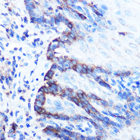 PDGFA Rabbit Polyclonal Antibody