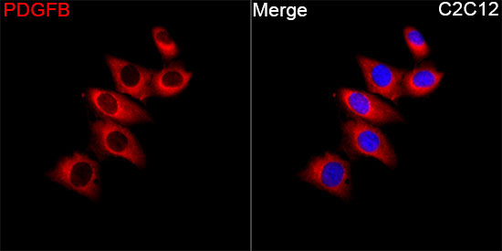 PDGFB Rabbit Polyclonal Antibody