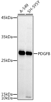 PDGFB Rabbit Polyclonal Antibody