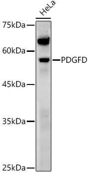 PDGFD Rabbit Polyclonal Antibody