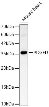 PDGFD Rabbit Polyclonal Antibody