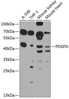 PDGFD Rabbit Polyclonal Antibody