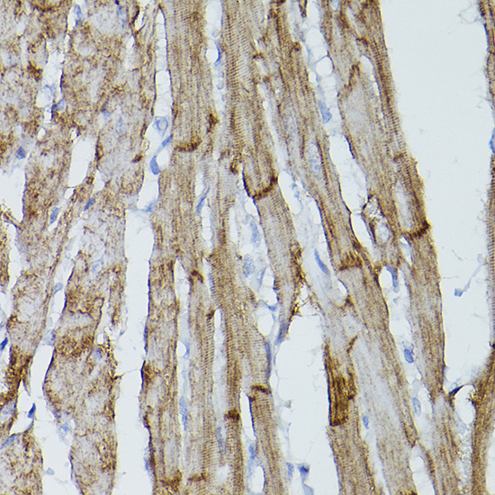 PDGFR alpha Rabbit Polyclonal Antibody - Image 2
