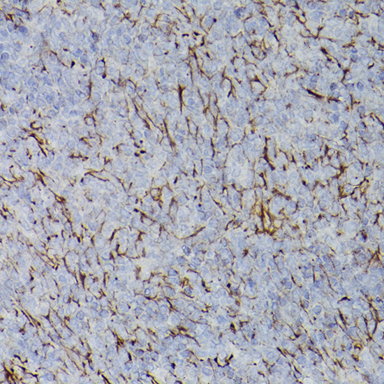 PDGFR alpha Rabbit Polyclonal Antibody - Image 3