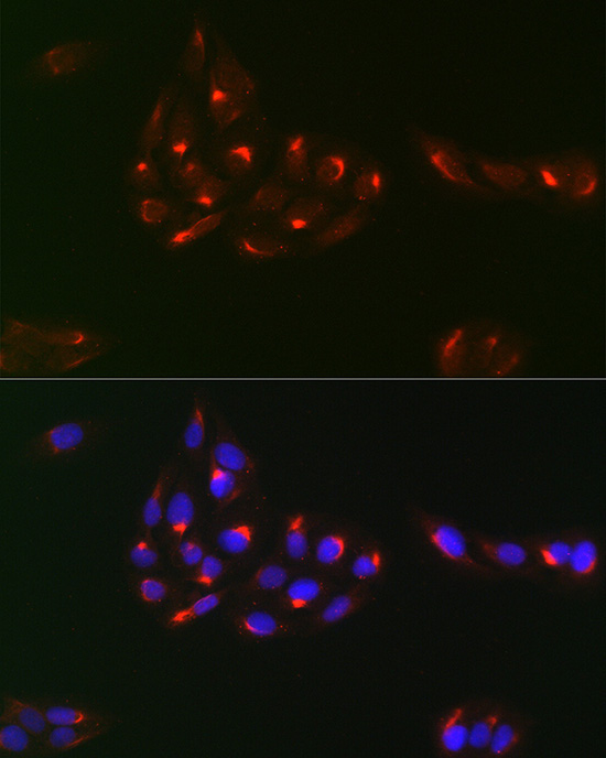 PDGFR alpha Rabbit Polyclonal Antibody - Image 4