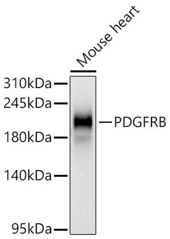 PDGFRB Rabbit Monoclonal Antibody