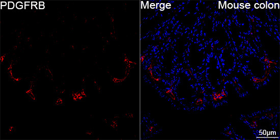 PDGFRB Rabbit Monoclonal Antibody - Image 2
