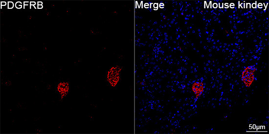 PDGFRB Rabbit Monoclonal Antibody - Image 3