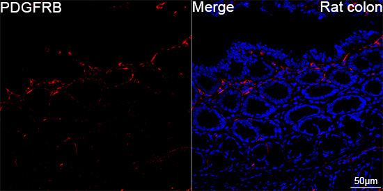 PDGFRB Rabbit Monoclonal Antibody - Image 4