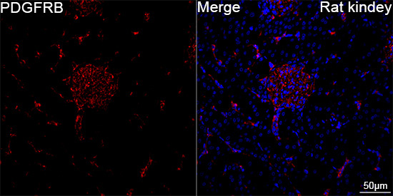PDGFRB Rabbit Monoclonal Antibody - Image 5