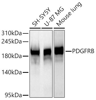PDGFRB Rabbit Monoclonal Antibody - Image 6