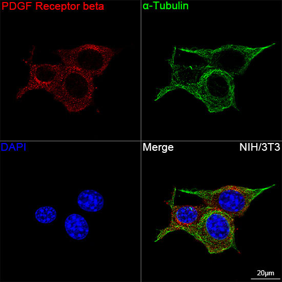 PDGFRB Rabbit Monoclonal Antibody - Image 7