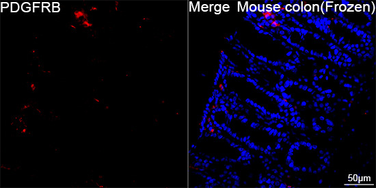 PDGFRB Rabbit Monoclonal Antibody - Image 8