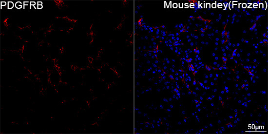 PDGFRB Rabbit Monoclonal Antibody - Image 9