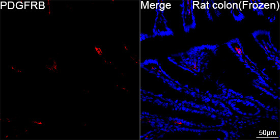 PDGFRB Rabbit Monoclonal Antibody - Image 10