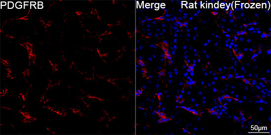 PDGFRB Rabbit Monoclonal Antibody - Image 11