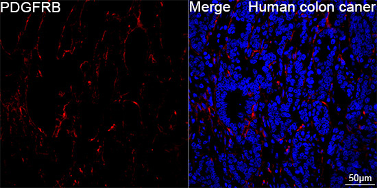 PDGFRB Rabbit Monoclonal Antibody - Image 12