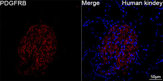 PDGFRB Rabbit Monoclonal Antibody - Image 13