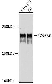 PDGFRB Rabbit Polyclonal Antibody