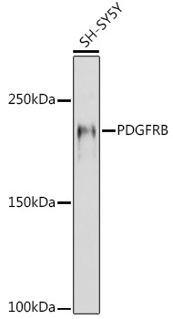 PDGFRB Rabbit Polyclonal Antibody - Image 2