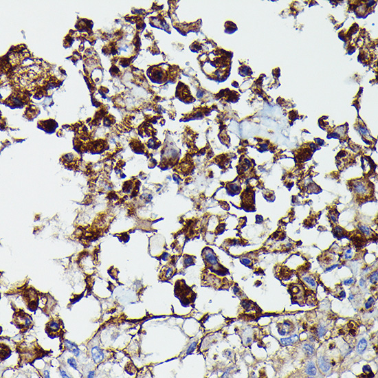 PDGFRB Rabbit Polyclonal Antibody - Image 3
