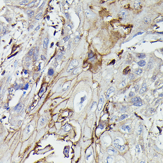 PDGFRB Rabbit Polyclonal Antibody - Image 4