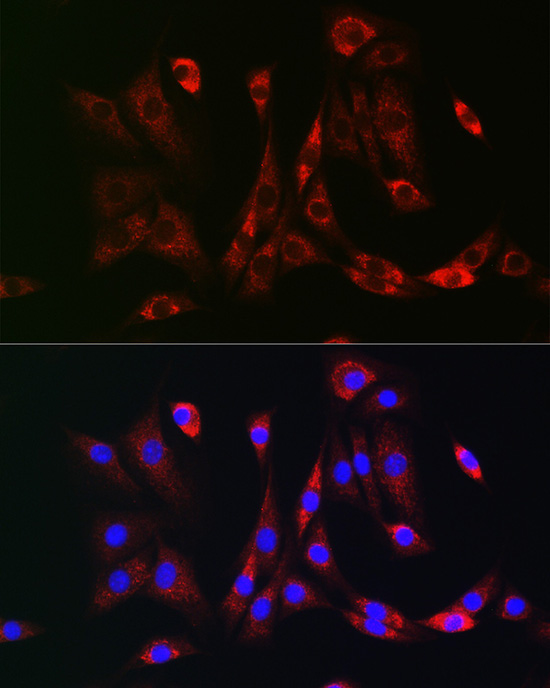 PDGFRB Rabbit Polyclonal Antibody - Image 5