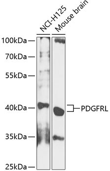 PDGFRL Rabbit Polyclonal Antibody