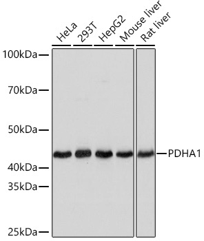 PDHA1 Rabbit Monoclonal Antibody