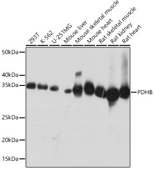 PDHB Rabbit Monoclonal Antibody