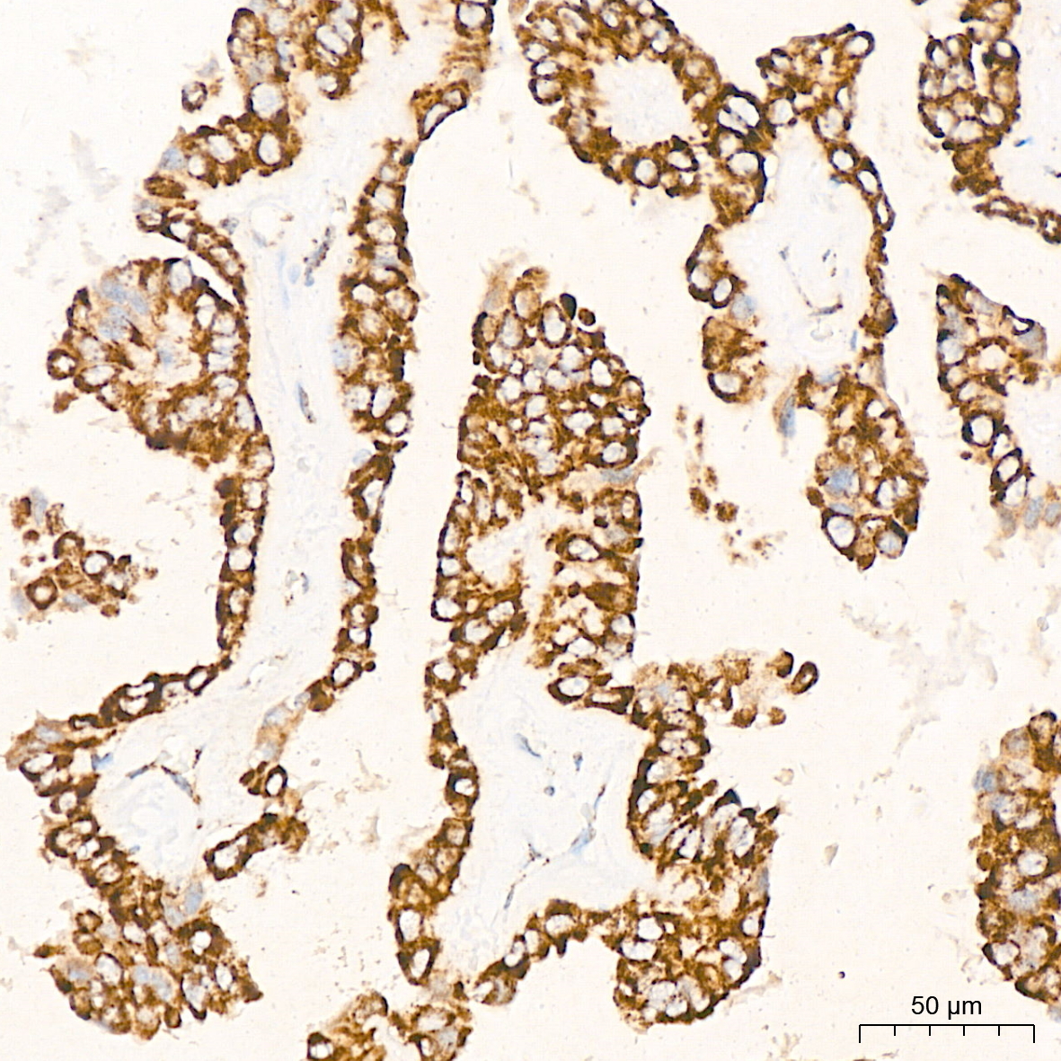 PDHB Rabbit Monoclonal Antibody - Image 2