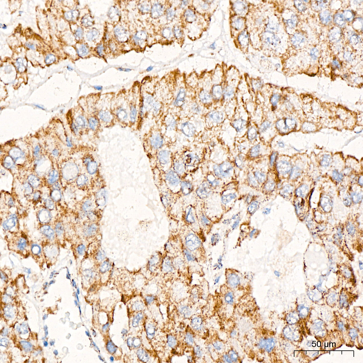 PDHB Rabbit Monoclonal Antibody - Image 3