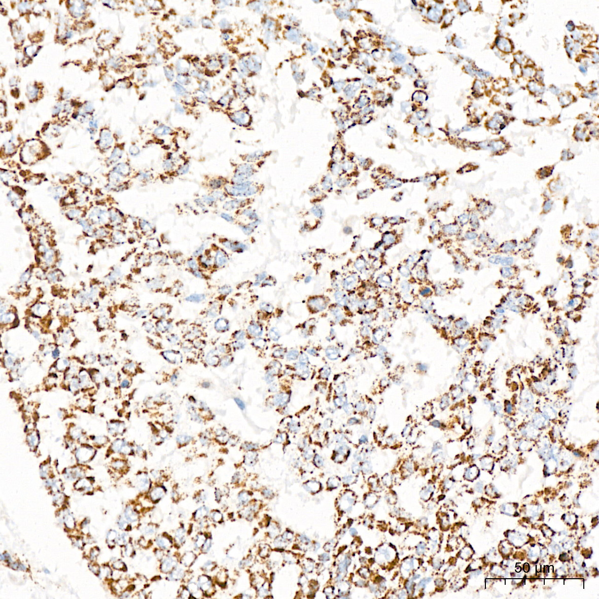 PDHB Rabbit Monoclonal Antibody - Image 4