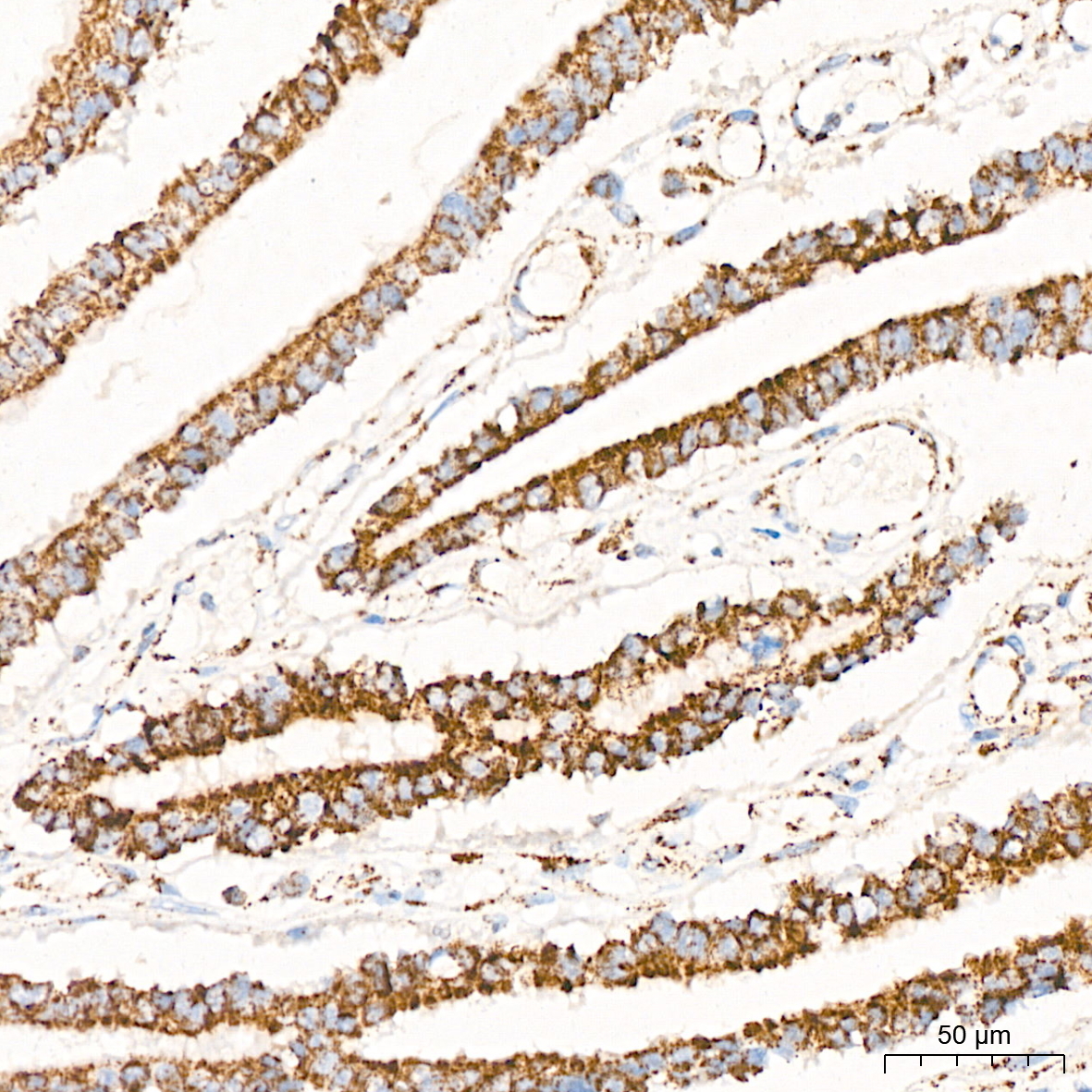 PDHB Rabbit Monoclonal Antibody - Image 5
