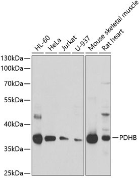 PDHB Rabbit Polyclonal Antibody