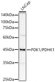 PDK1/PDHK1 Rabbit Monoclonal Antibody