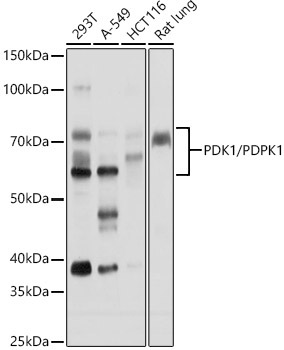 PDK1/PDPK1 Rabbit Polyclonal Antibody