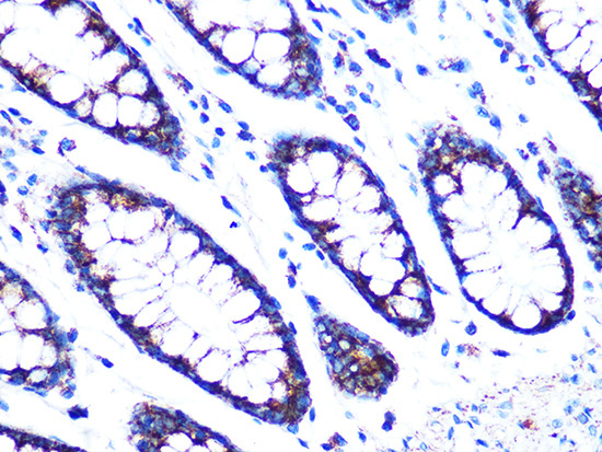 PDK2 Rabbit Monoclonal Antibody - Image 2